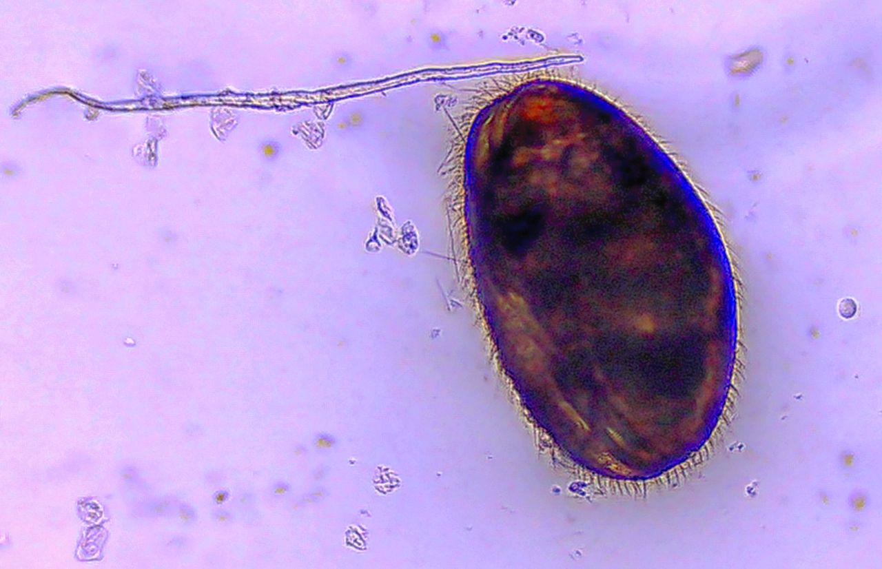 I signori del fango: gli Ostracodi